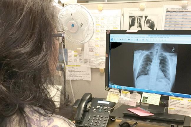 nurse viewing a chest x-ray