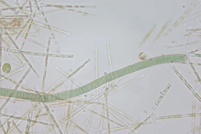 Imagen microscópica de cianobacterias